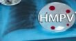 HMPV
